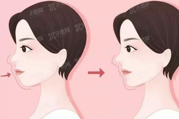 齐齐哈尔矫正牙齿费用价格表