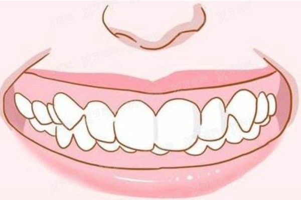 齐齐哈尔矫正牙齿费用价格表