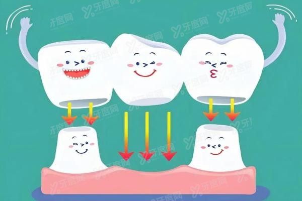 良心牙医不建议做全瓷牙