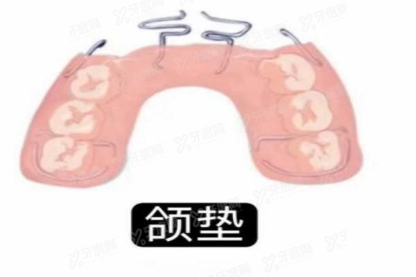 深覆合平导和颌垫区别