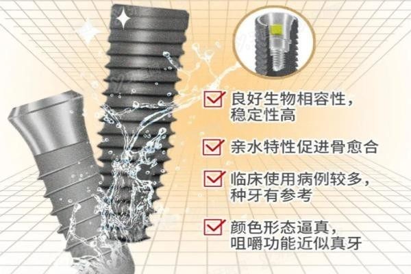 种植牙诺贝尔和iti有什么区别