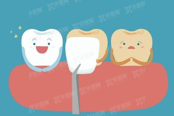厦门登特口腔医院牙贴面医生介绍