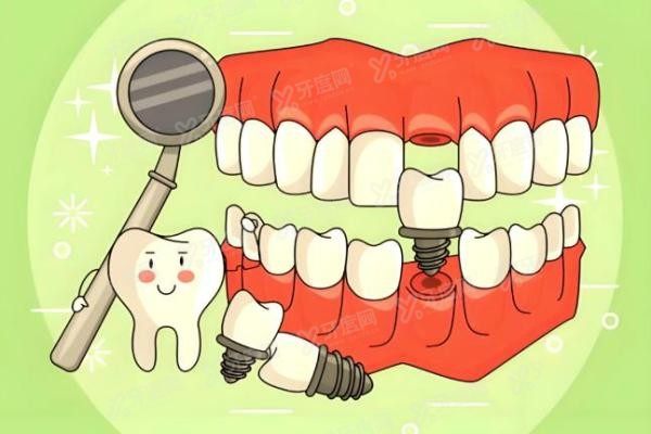 深圳市人民医院口腔科挂号预约