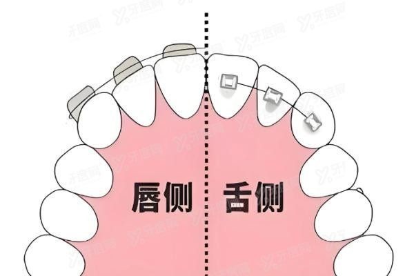 上海正畸医生推荐