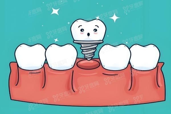 韩国科威尔和登腾的区别