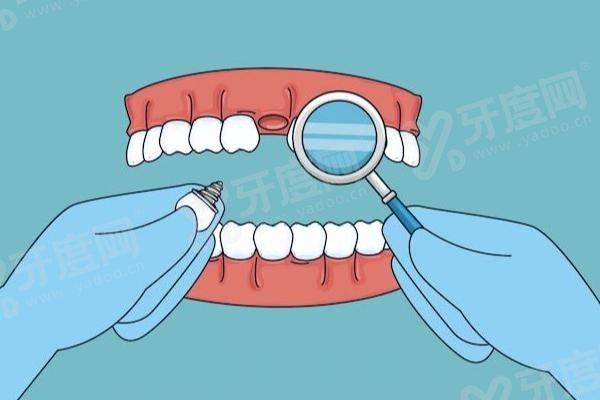 20250930773510.jpg 种植牙.jpg