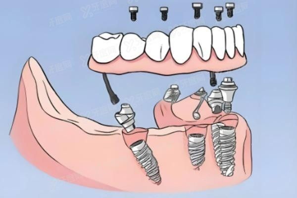 成都川禾口腔医院口碑评价