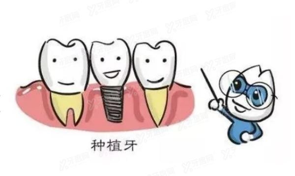 创英种植体是哪个国家的