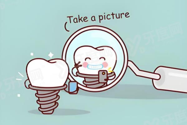 创英种植牙多少钱一颗