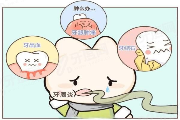 20251105253754.jpg 牙周炎.jpg