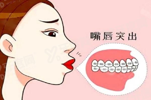 20251105575384.jpg 凸嘴1.jpg