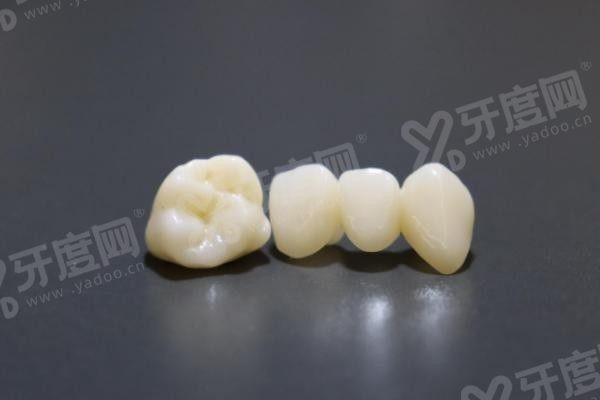 20251105880981.jpg 牙冠1.jpg