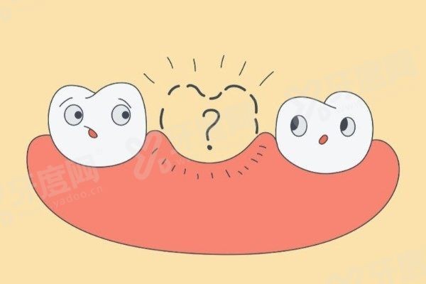 南京全口种植牙医院哪家好 南京全口种植牙医院哪家好