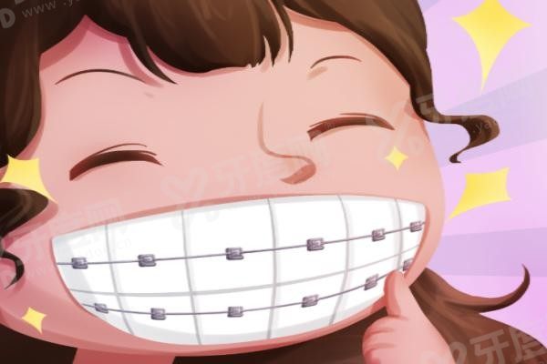 骨性深覆合正畸怎么样