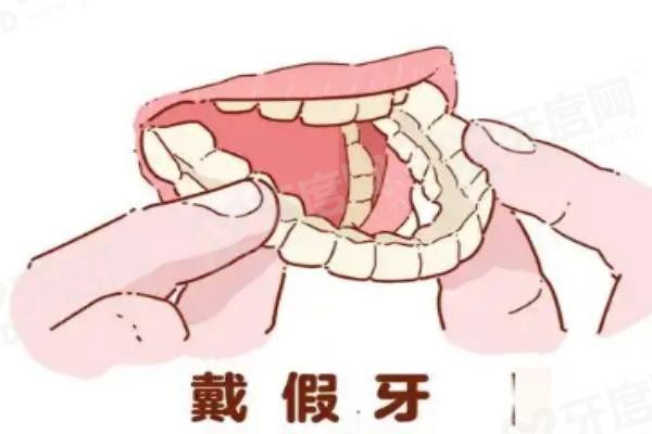 成都玉安牙种植医院价格表
