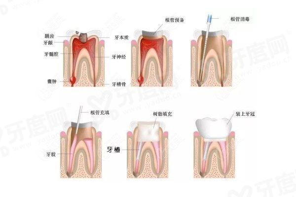 重庆云阳牙科医院排行榜,重庆云阳牙科医院排名前三 重庆云阳牙科医院排行榜,重庆云阳牙科医院排名前三