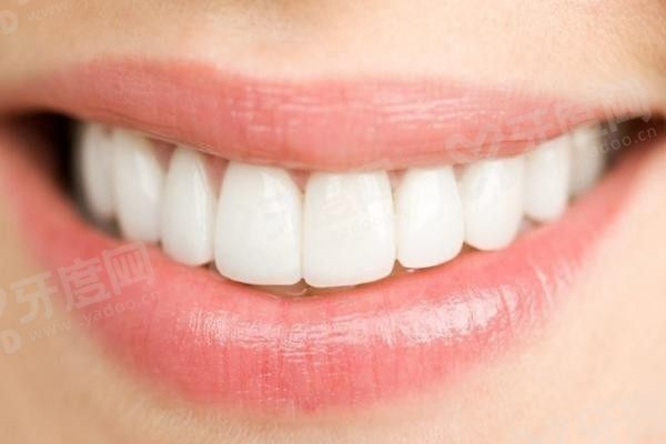 20251125689769.jpg 牙齿美白1.jpg