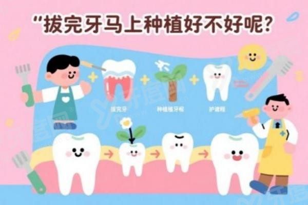 湘潭种植牙价格表,湘潭种植牙哪家做得好