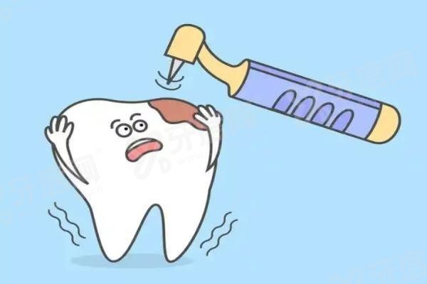 20251127866138.jpg 根管治疗3.jpg