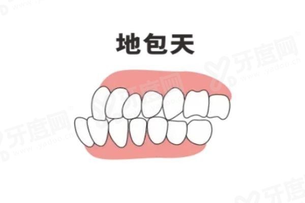 20251127643910.jpg 地包天.jpg