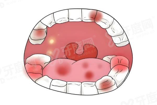 湖南湘乡种植牙好的医院排名榜,湖南湘乡种植牙好的医院排名前三