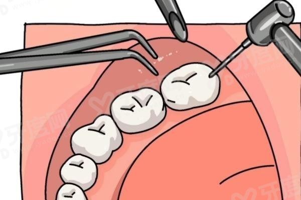 20251204478967.jpg 拔牙.jpg