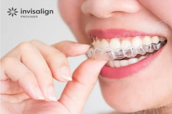 20251222264181.jpg 隐形牙套1.jpg