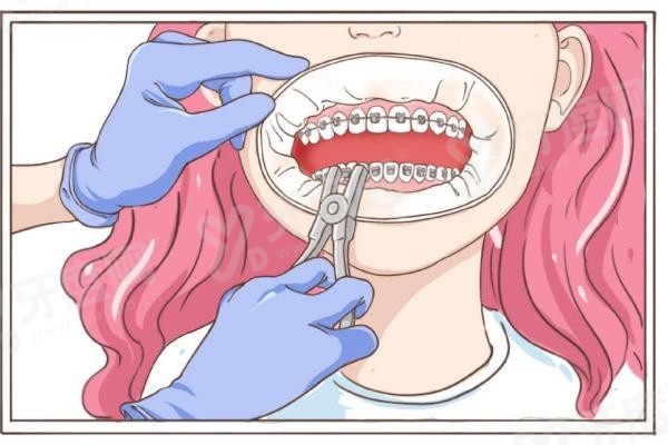 矫正牙齿卡通图3(1).jpg